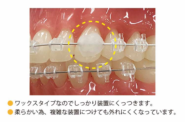 ｵｰｿﾜｯｸｽ